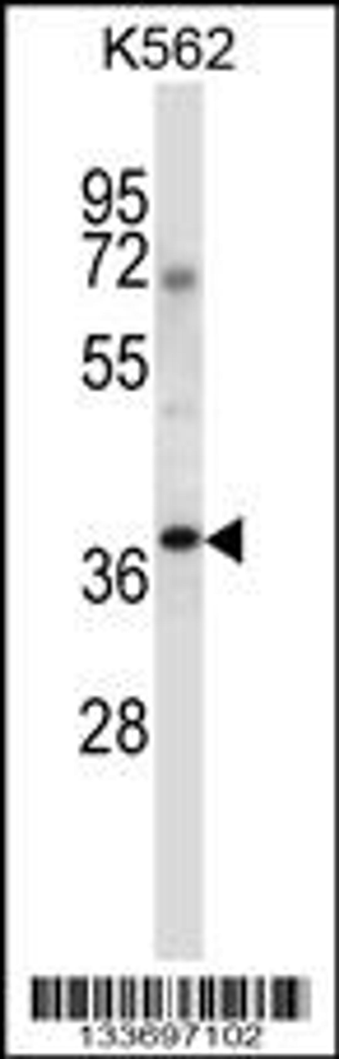 Western blot analysis in K562 cell line lysates (35ug/lane).