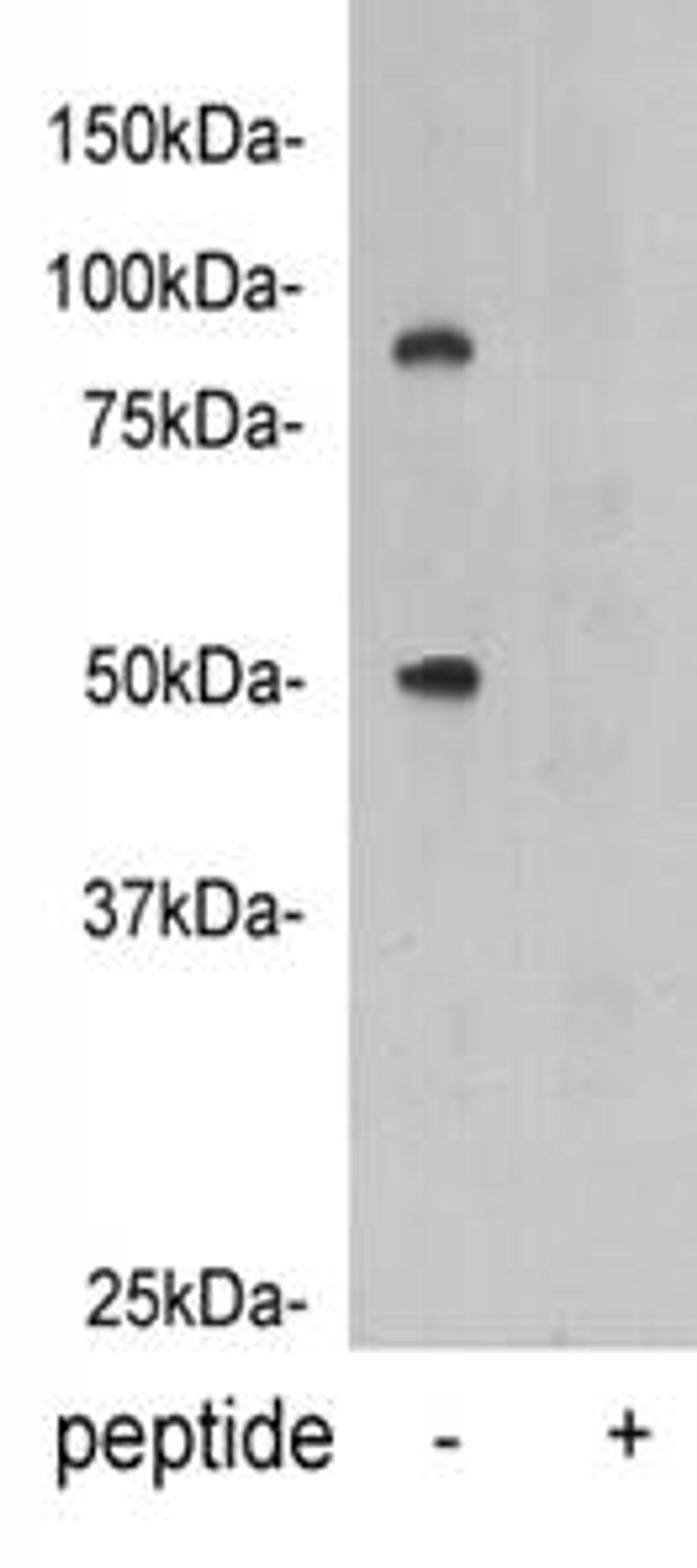 Western Blot analysis of human plasma using Vitamin K-dependent protein C antibody