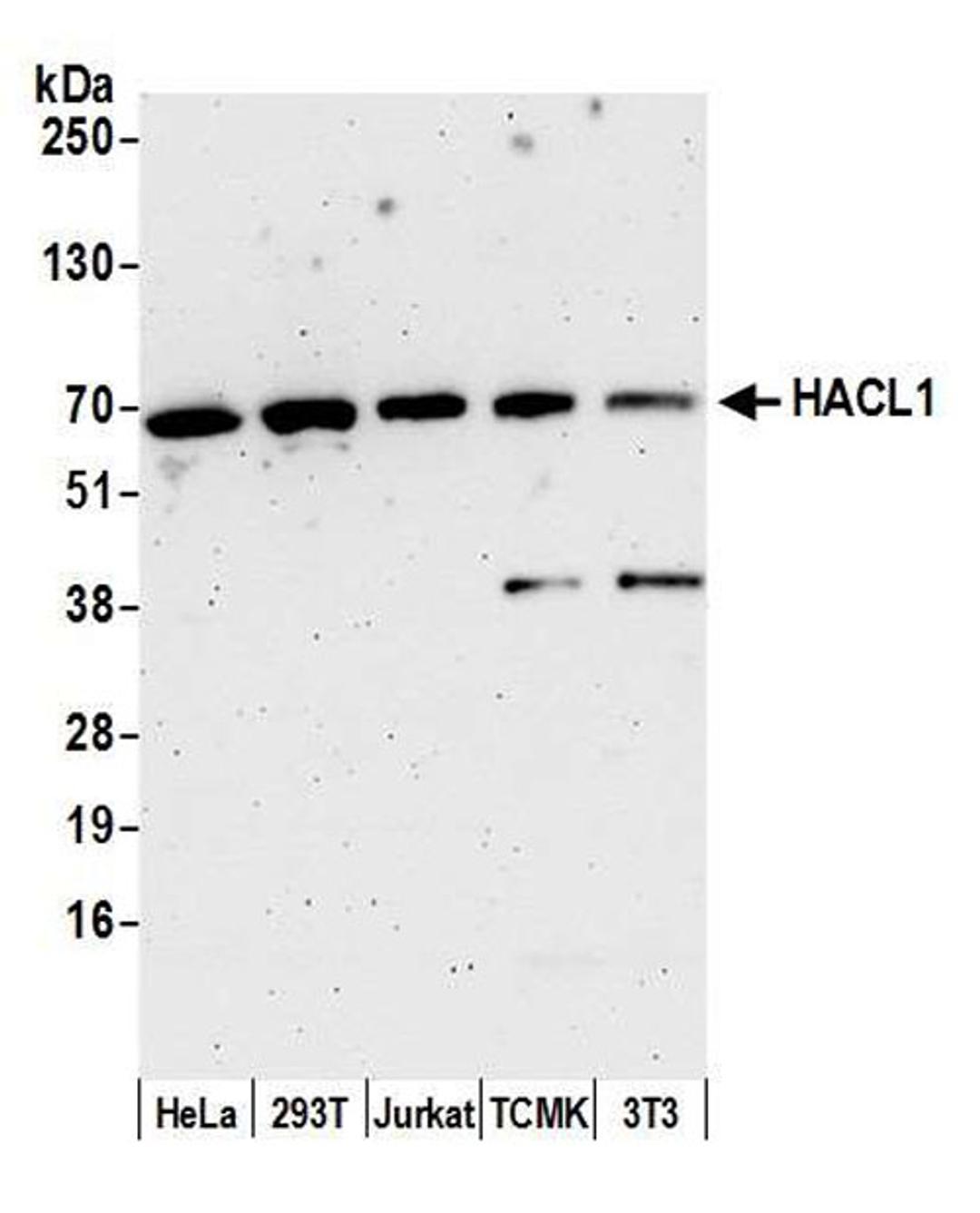 Detection of human and mouse HACL1 by WB.