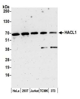 Detection of human and mouse HACL1 by WB.