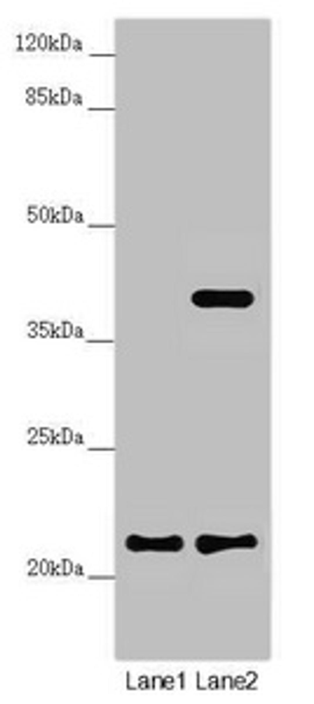 Western blot. All lanes: DCTN6 antibody at 3.5 ug/ml. Lane 1: A549 whole cell lysate. Lane 2: U251 whole cell lysate. Secondary. Goat polyclonal to rabbit IgG at 1/10000 dilution. Predicted band size: 21 kDa. Observed band size: 21, 40 kDa.