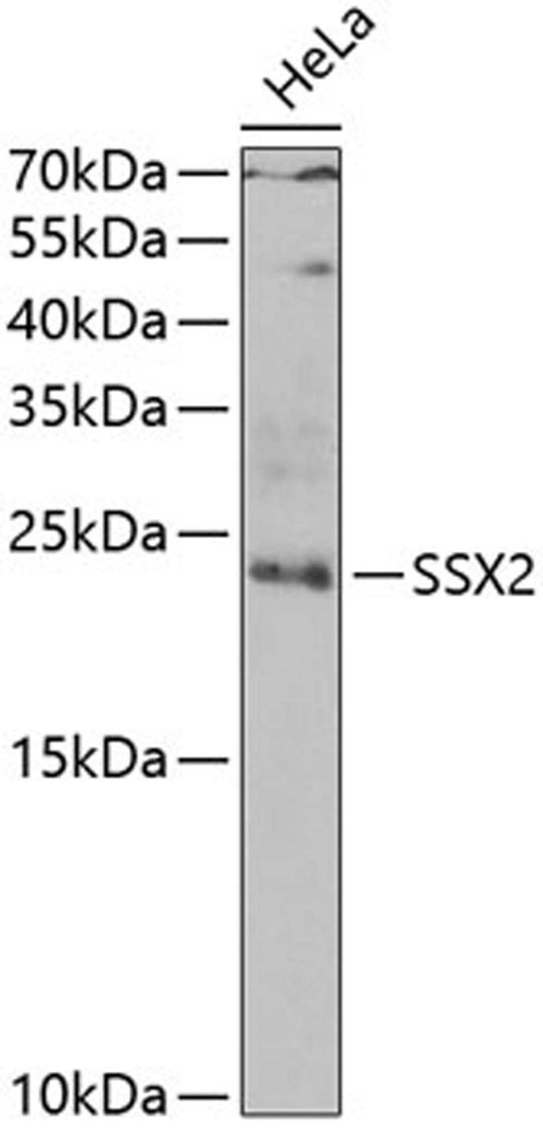 Western blot - SSX2 antibody (A6989)