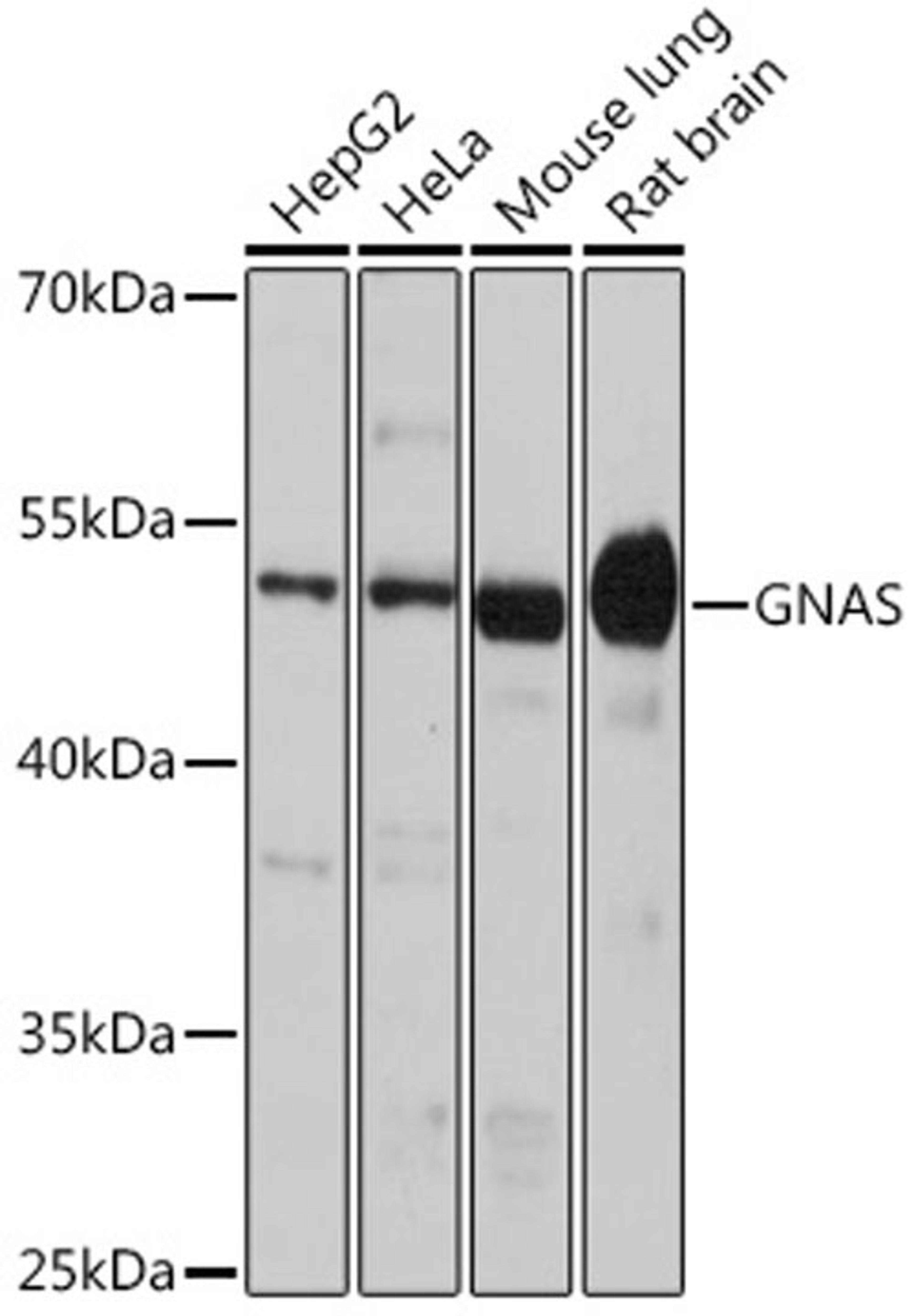 Western blot - GNAS antibody (A5546)