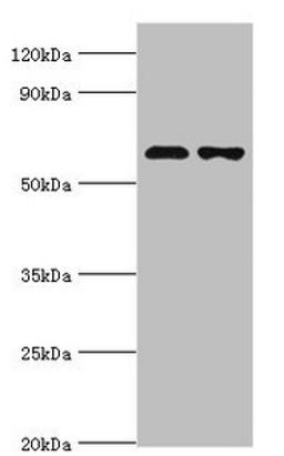 Western blot. All lanes: Sterol O-acyltransferase 1 antibody at 2ug/ml. Lane 1: 293T whole cell lysate. Lane 2: Jurkat whole cell lysate. Secondary. Goat polyclonal to rabbit IgG at 1/10000 dilution. Predicted band size: 65, 59, 58 kDa. Observed band size: 65 kDa.
