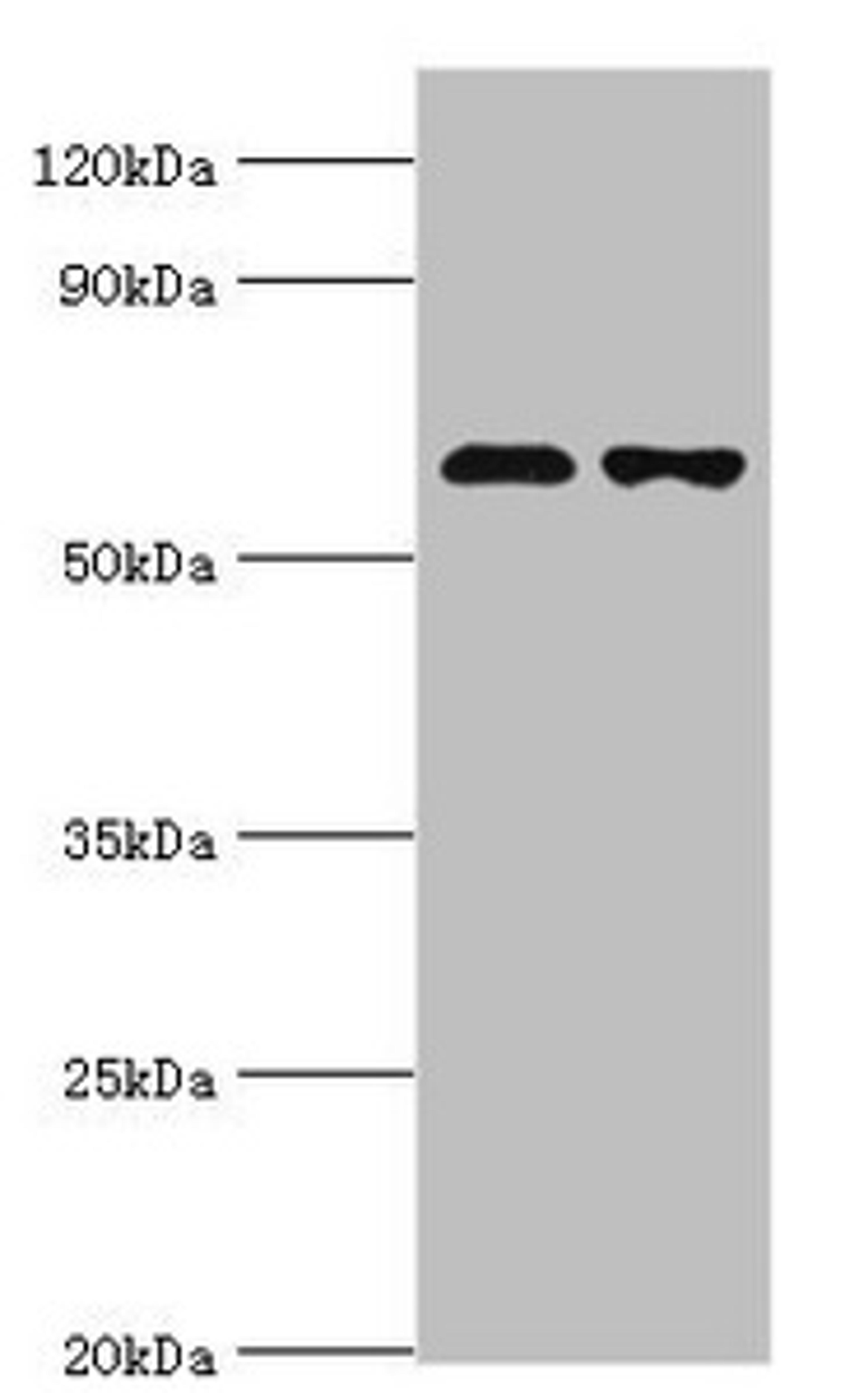 Western blot. All lanes: Sterol O-acyltransferase 1 antibody at 2ug/ml. Lane 1: 293T whole cell lysate. Lane 2: Jurkat whole cell lysate. Secondary. Goat polyclonal to rabbit IgG at 1/10000 dilution. Predicted band size: 65, 59, 58 kDa. Observed band size: 65 kDa.