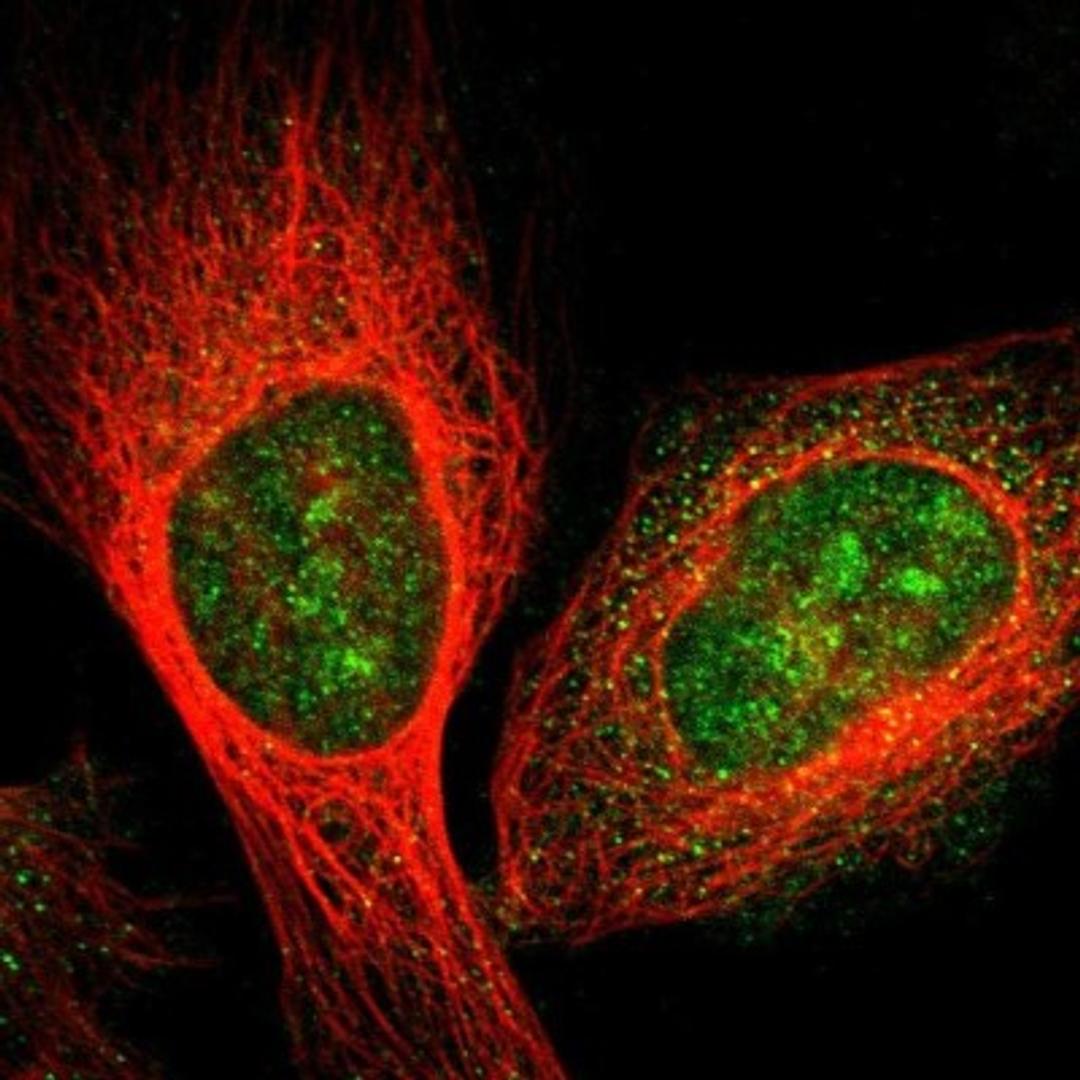 Immunocytochemistry/Immunofluorescence: GRAMD1B Antibody [NBP1-81431] - Staining of human cell line U-2 OS shows positivity in nucleus & nucleoli.