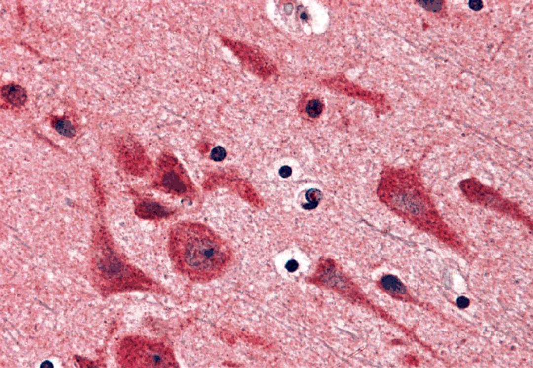 Immunohistochemistry of TAB2 in human brain tissue with TAB2 antibody at 5 μg/mL.