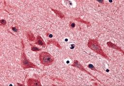 Immunohistochemistry of TAB2 in human brain tissue with TAB2 antibody at 5 μg/mL.