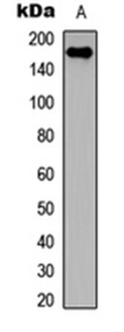 Western blot analysis of COLO205 (Lane 1) whole cell lysates using Collagen 11 alpha 2 antibody