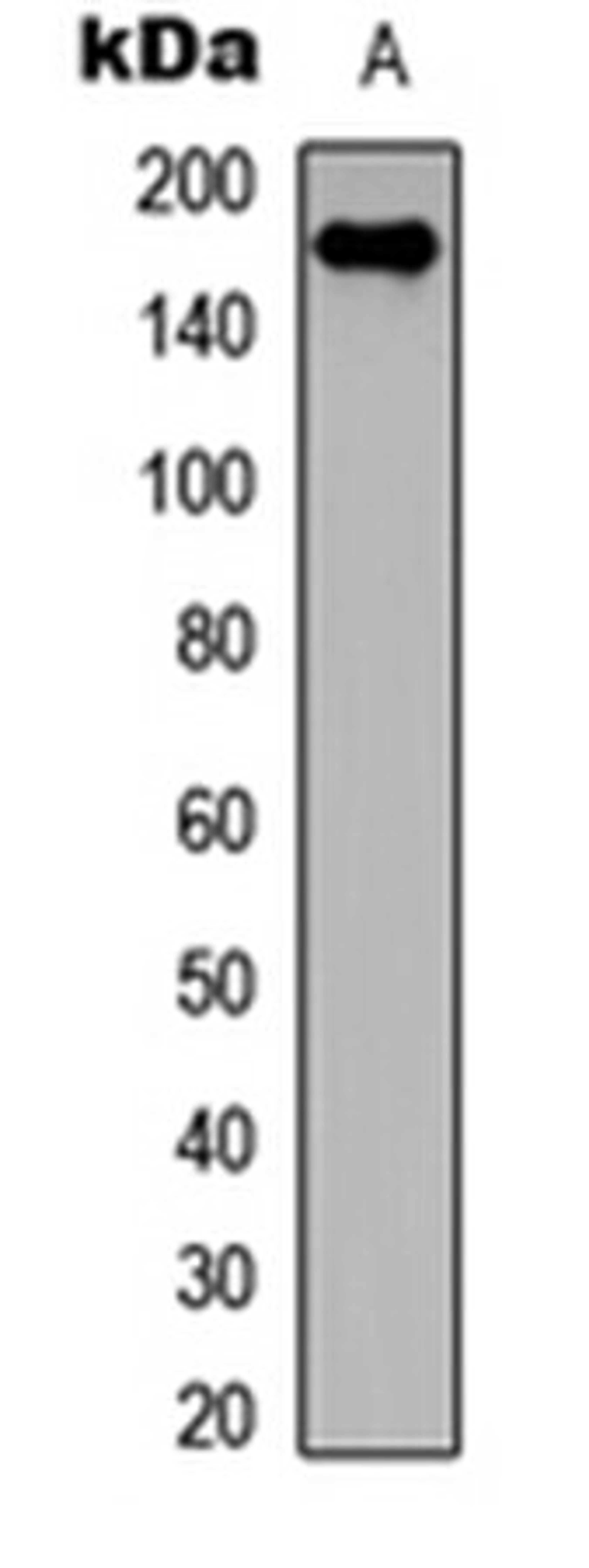 Western blot analysis of COLO205 (Lane 1) whole cell lysates using Collagen 11 alpha 2 antibody