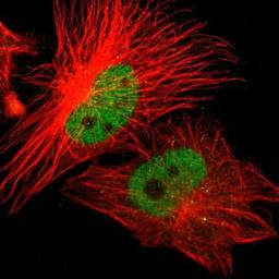 Immunocytochemistry/Immunofluorescence: ZNF701 Antibody [NBP1-83815] - Staining of human cell line U-251MG shows positivity in nucleus but not nucleoli.