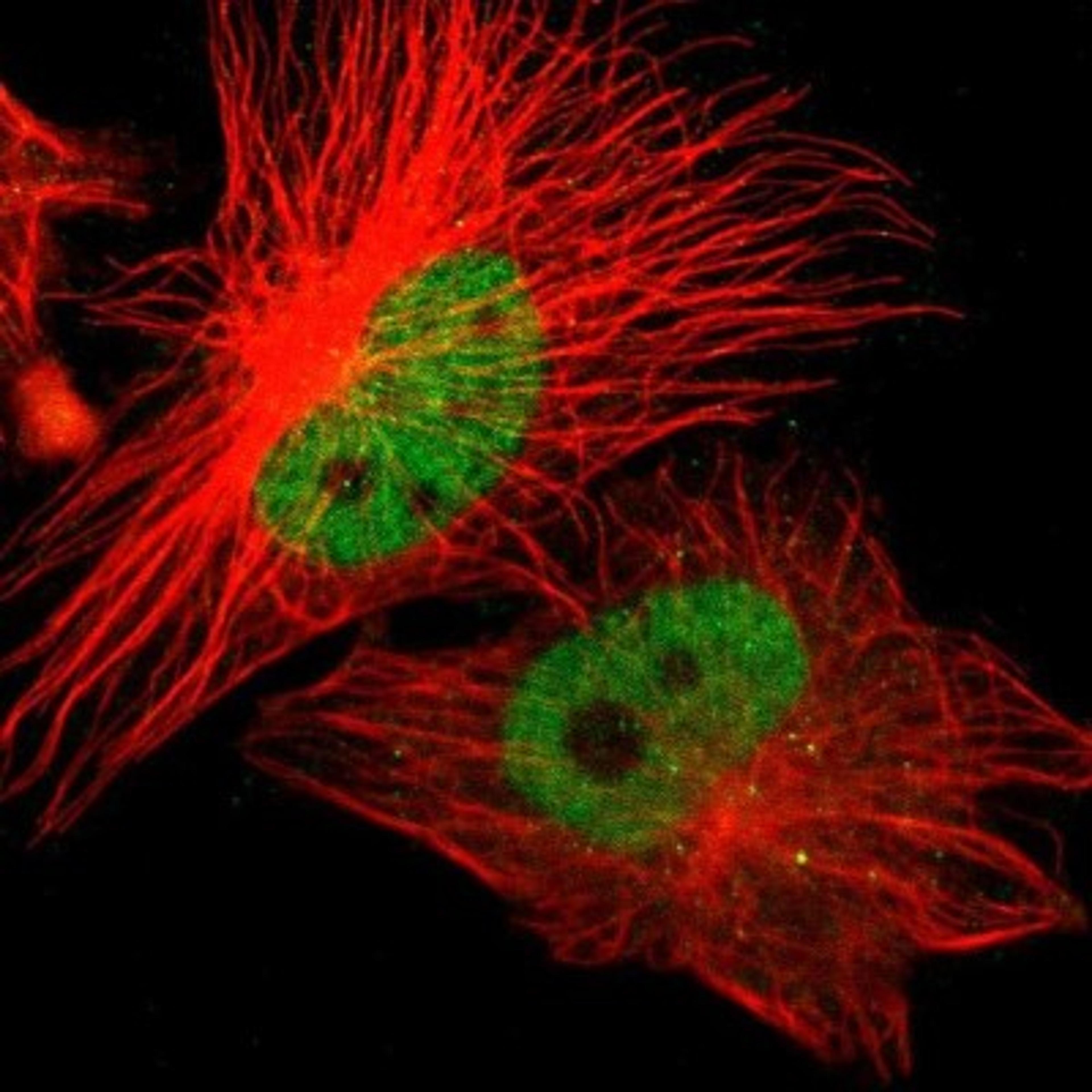 Immunocytochemistry/Immunofluorescence: ZNF701 Antibody [NBP1-83815] - Staining of human cell line U-251MG shows positivity in nucleus but not nucleoli.