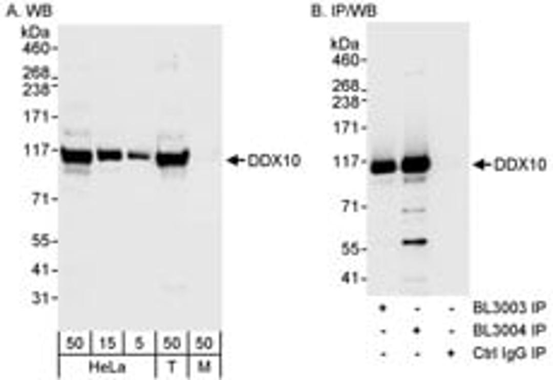 Detection of human DDX10 by western blot and immunoprecipitation.