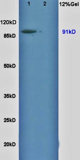 Western blot analysis of rat brain lysates(Lane1),rat liver lysates(Lane2) using NHE1 antibody