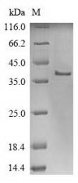(Tris-Glycine gel) Discontinuous SDS-PAGE (reduced) with 5% enrichment gel and 15% separation gel.