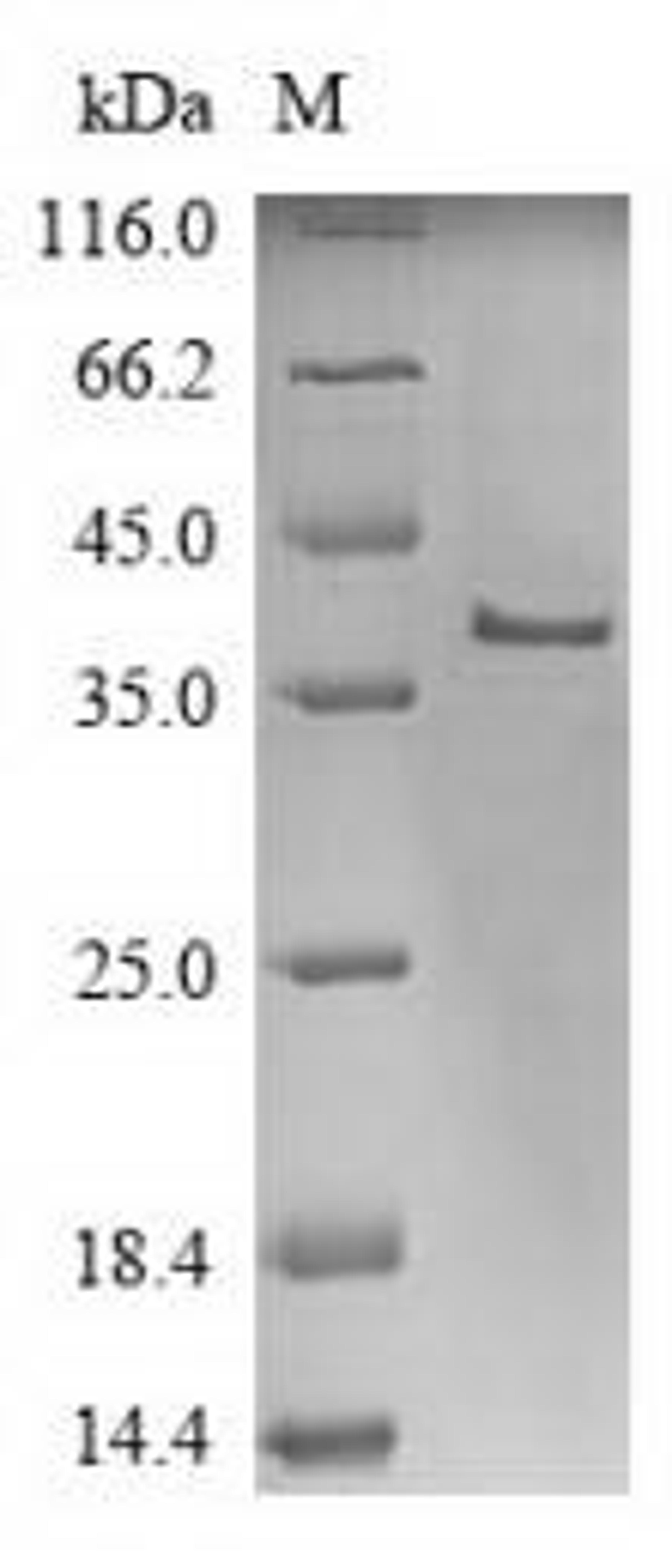 (Tris-Glycine gel) Discontinuous SDS-PAGE (reduced) with 5% enrichment gel and 15% separation gel.