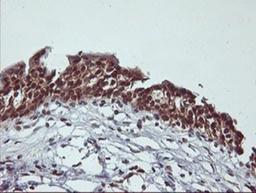 Immunohistochemistry-Paraffin: Cytochrome P450 2A6 Antibody (1D2) [NBP2-01437] - Staining of paraffin-embedded Human bladder tissue using anti-Cytochrome P450 2A6 mouse monoclonal antibody.