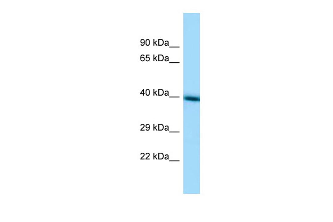 Antibody used in WB on Human HepG2 at 1 ug/ml.