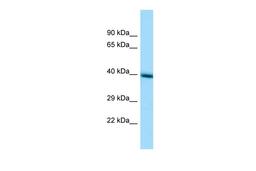 Antibody used in WB on Human HepG2 at 1 ug/ml.