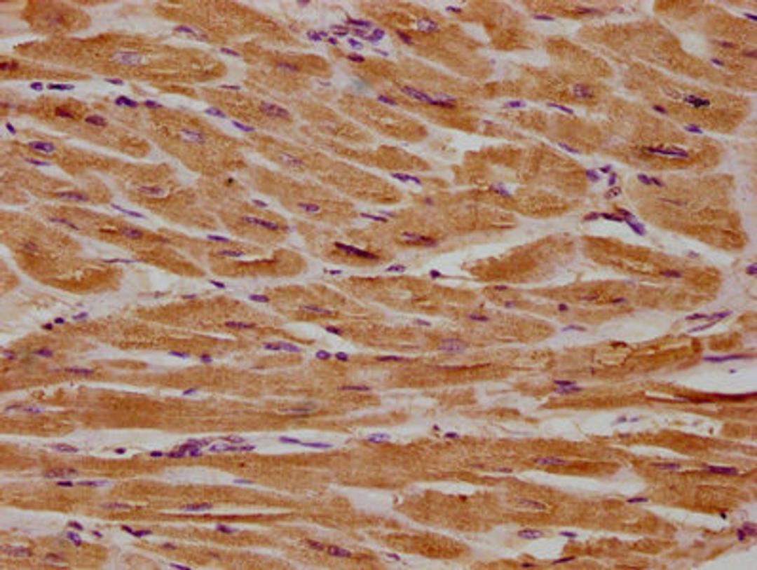 IHC image of CSB-PA860321LA01HU diluted at 1:300 and staining in paraffin-embedded human heart tissue performed on a Leica BondTM system. After dewaxing and hydration, antigen retrieval was mediated by high pressure in a citrate buffer (pH 6.0). Section was blocked with 10% normal goat serum 30min at RT. Then primary antibody (1% BSA) was incubated at 4°C overnight. The primary is detected by a biotinylated secondary antibody and visualized using an HRP conjugated SP system.