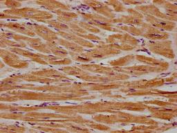 IHC image of CSB-PA860321LA01HU diluted at 1:300 and staining in paraffin-embedded human heart tissue performed on a Leica BondTM system. After dewaxing and hydration, antigen retrieval was mediated by high pressure in a citrate buffer (pH 6.0). Section was blocked with 10% normal goat serum 30min at RT. Then primary antibody (1% BSA) was incubated at 4°C overnight. The primary is detected by a biotinylated secondary antibody and visualized using an HRP conjugated SP system.