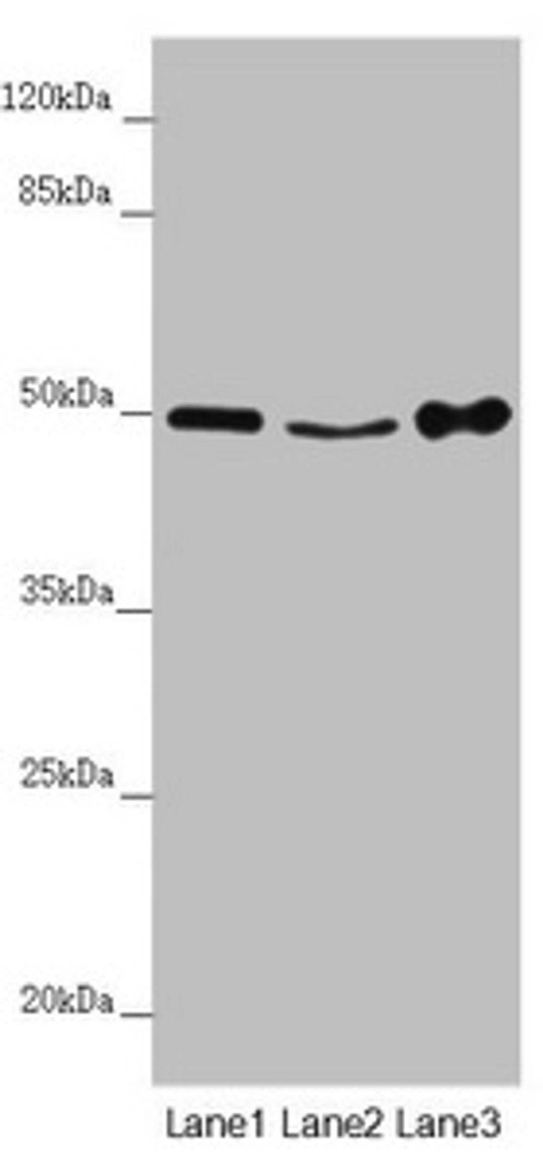 Western blot. All lanes: MYLIP antibody at 4.06 ug/ml. Lane 1: Mouse brain tissue. Lane 2: Mouse liver tissue. Lane 3: Mouse spleen tissue. Secondary. Goat polyclonal to rabbit IgG at 1/10000 dilution. Predicted band size: 50, 15 kDa. Observed band size: 50 kDa.