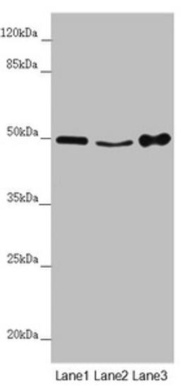 Western blot. All lanes: MYLIP antibody at 4.06 ug/ml. Lane 1: Mouse brain tissue. Lane 2: Mouse liver tissue. Lane 3: Mouse spleen tissue. Secondary. Goat polyclonal to rabbit IgG at 1/10000 dilution. Predicted band size: 50, 15 kDa. Observed band size: 50 kDa.