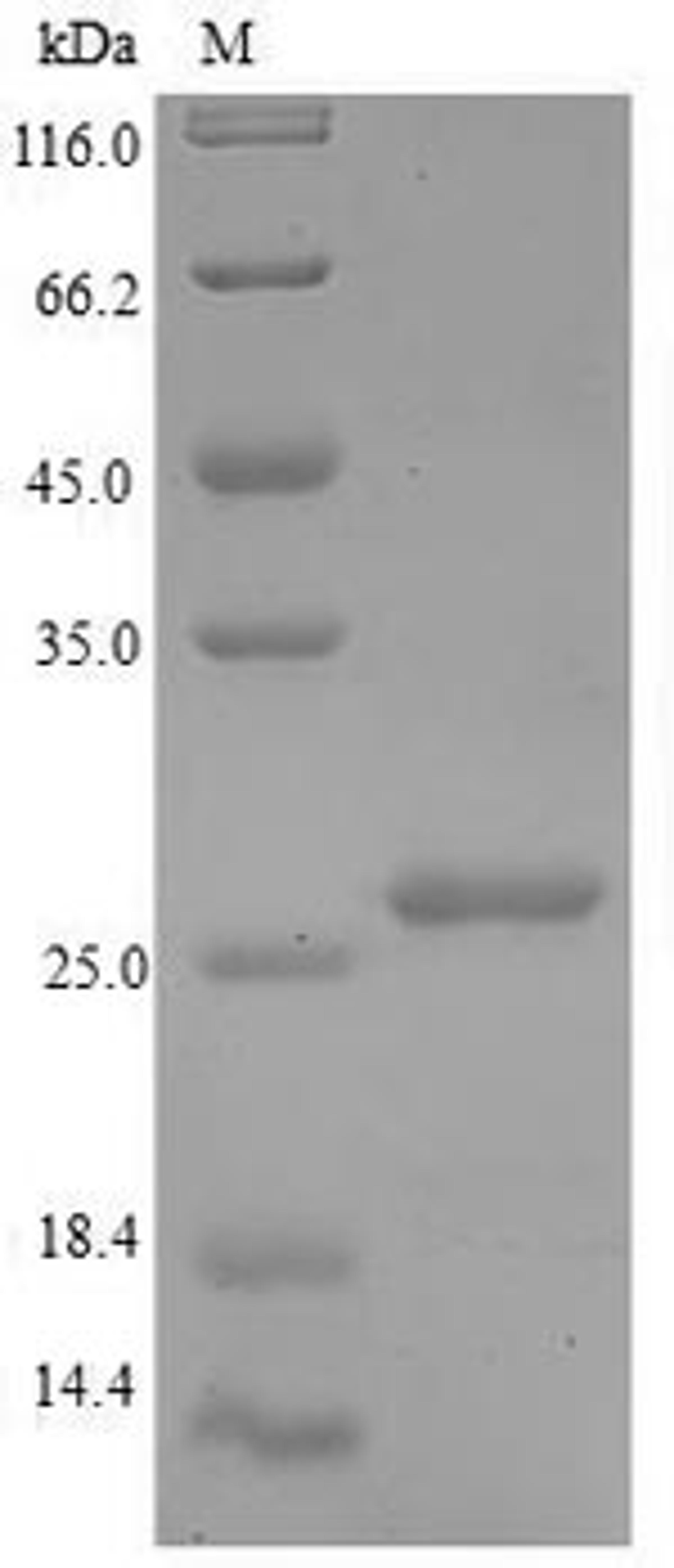 (Tris-Glycine gel) Discontinuous SDS-PAGE (reduced) with 5% enrichment gel and 15% separation gel.
