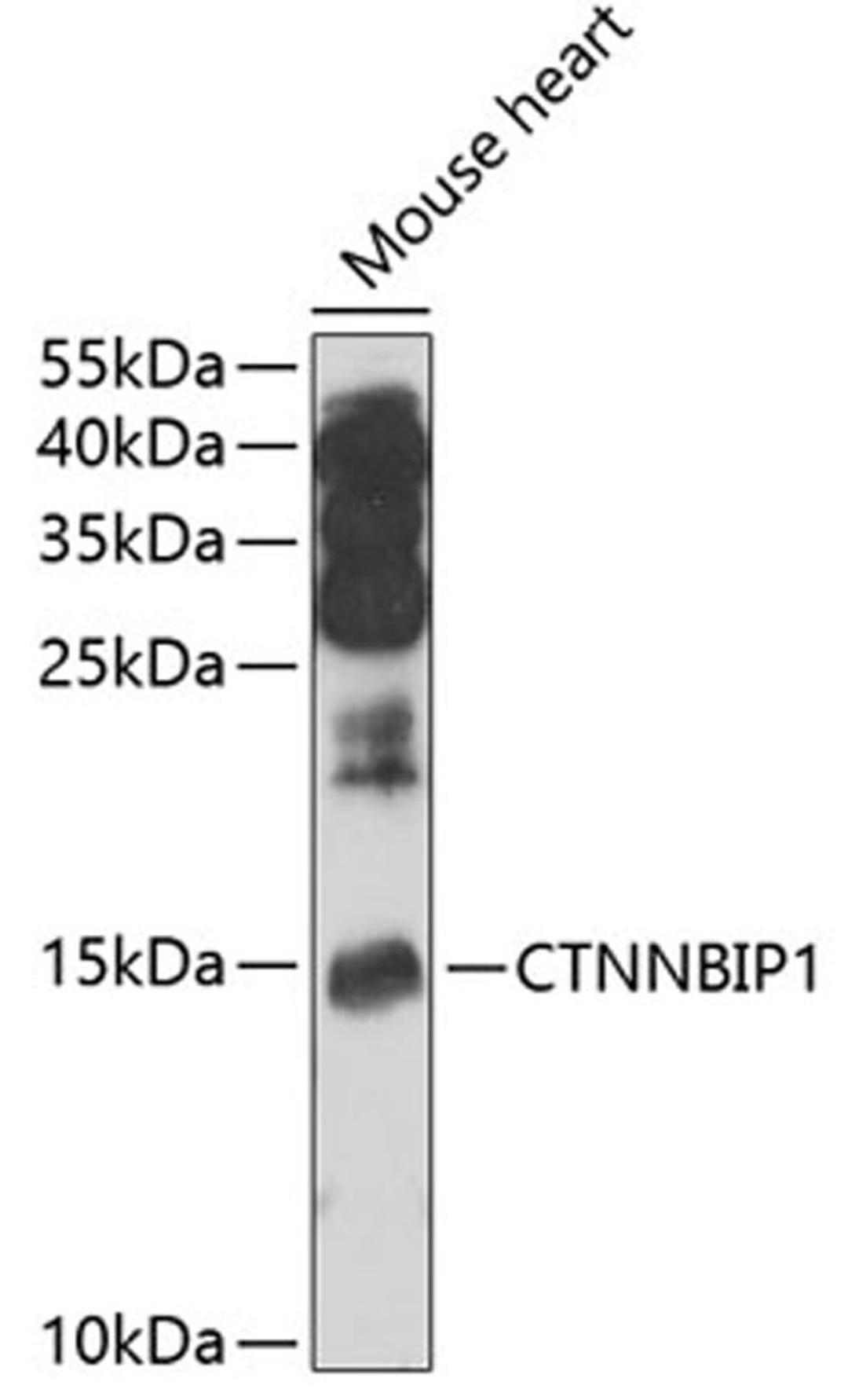 Western blot - CTNNBIP1 antibody (A7122)