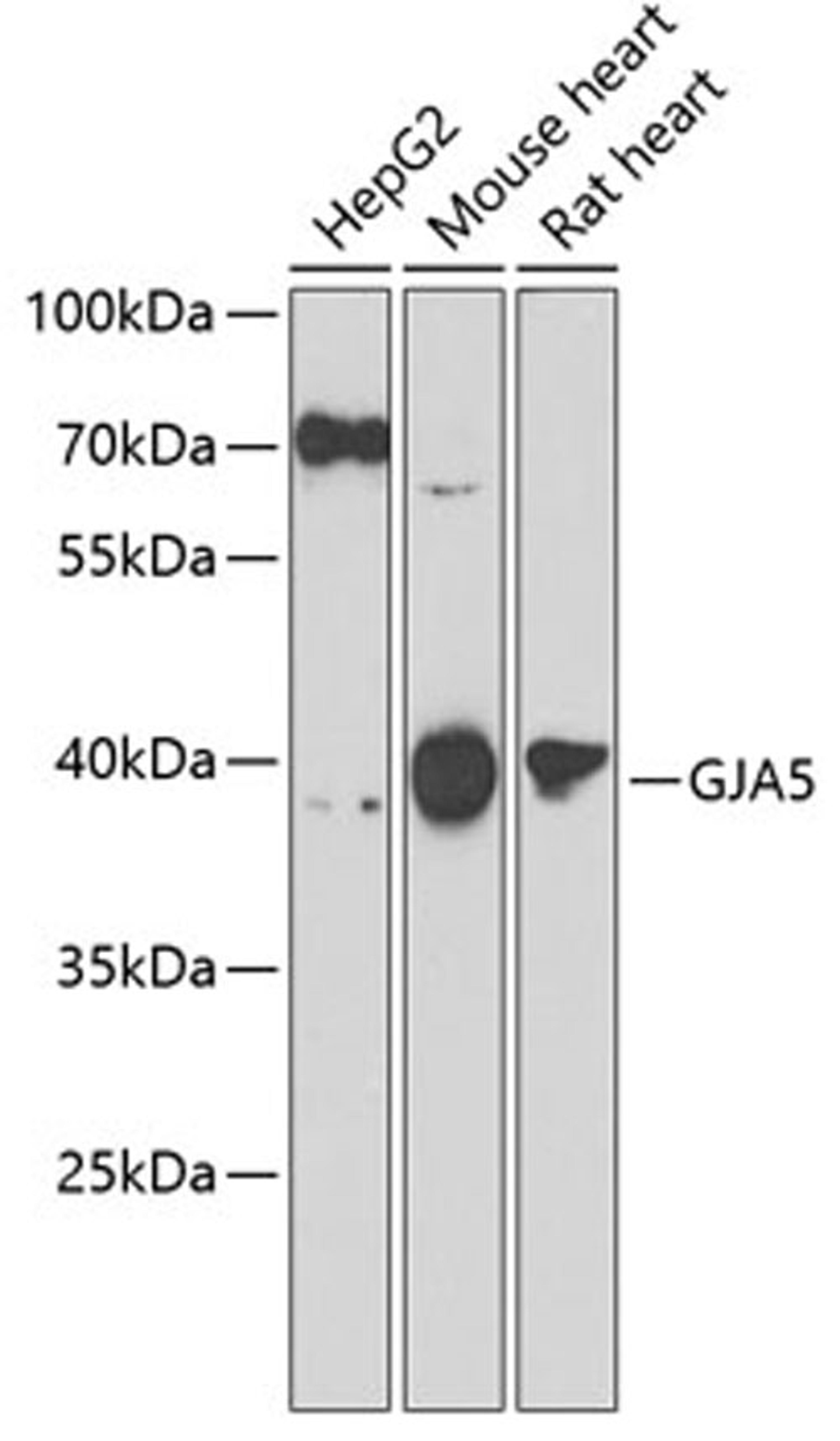 Western blot - GJA5 antibody (A7231)