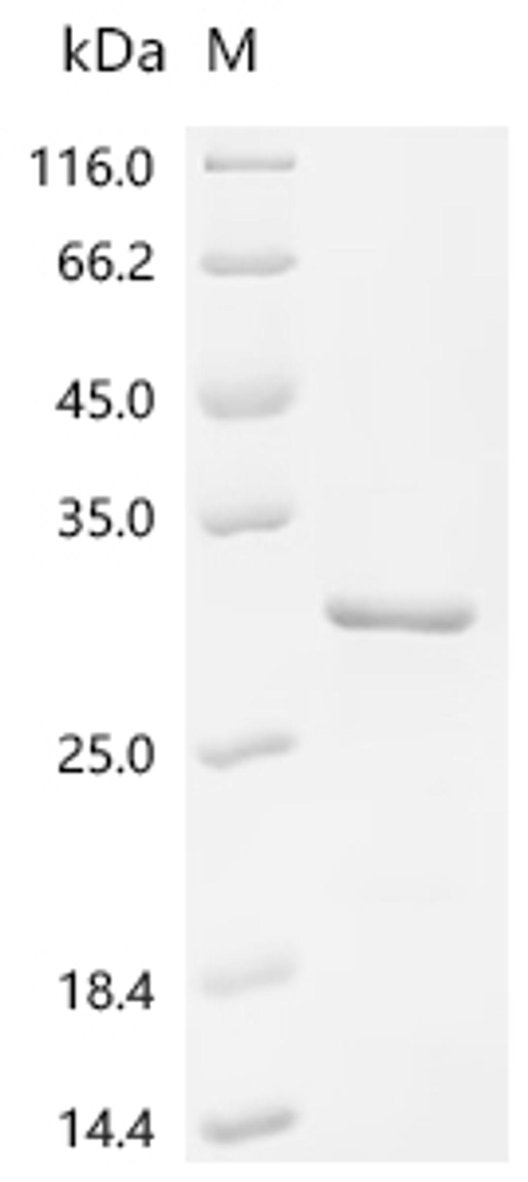 (Tris-Glycine gel) Discontinuous SDS-PAGE (reduced) with 5% enrichment gel and 15% separation gel.