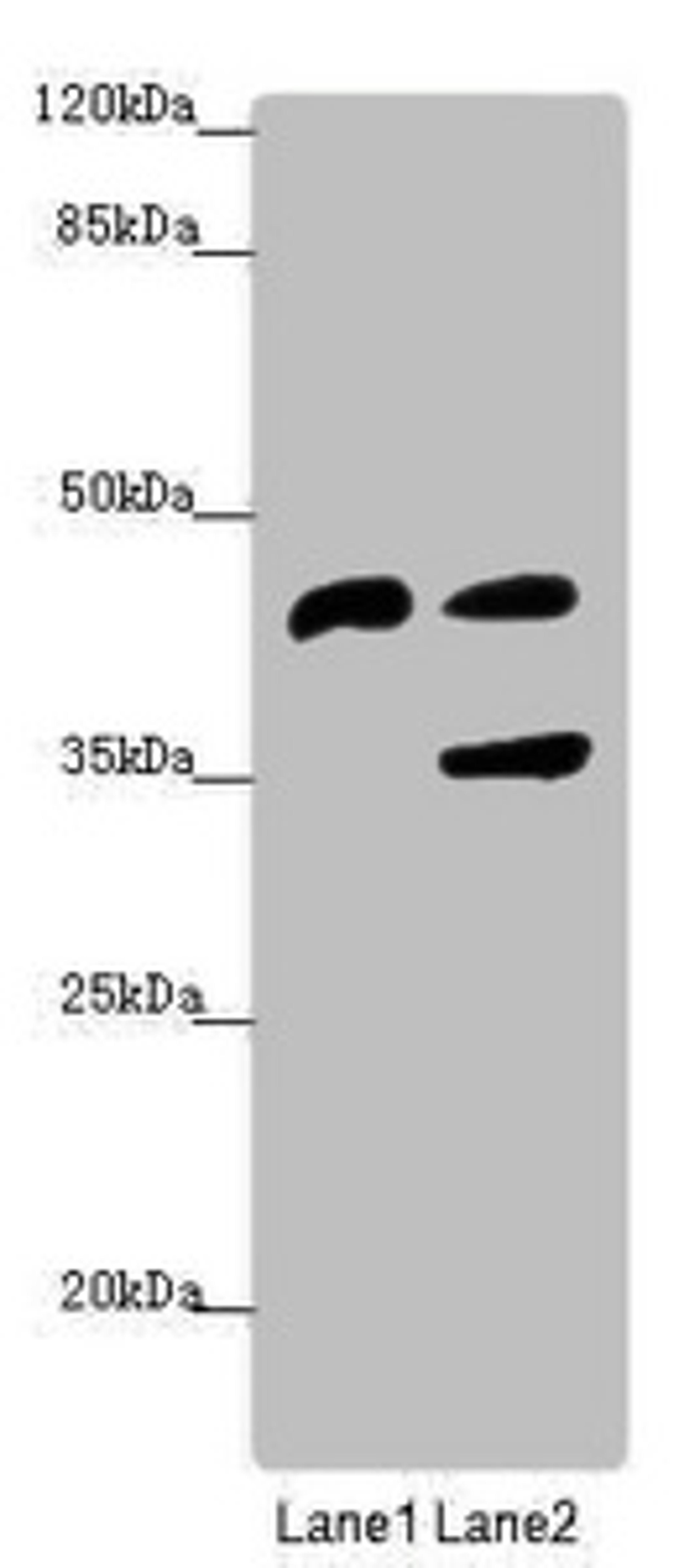 Western blot. All lanes: SERPINB6 antibody at 0.95 ug/ml. Lane 1: Human placenta tissue. Lane 2: HepG2 whole cell lysate. Secondary. Goat polyclonal to rabbit IgG at 1/10000 dilution. Predicted band size: 43 kDa. Observed band size: 43, 36 kDa.