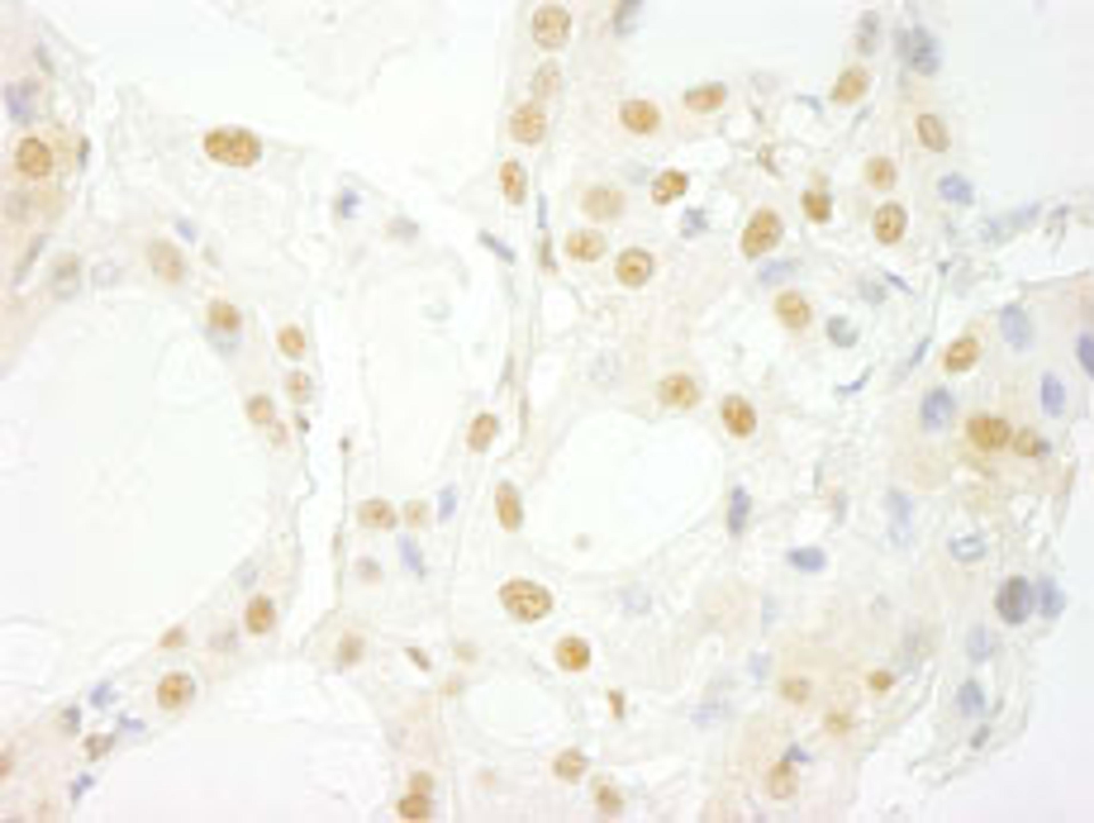 Detection of human PRPF4B by immunohistochemistry.