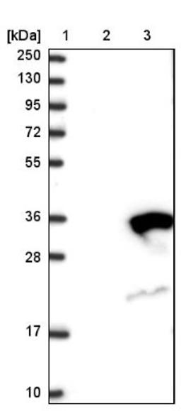 Western Blot: RAB23 Antibody [NBP1-86367] - Lane 1: Marker [kDa] 250, 130, 95, 72, 55, 36, 28, 17, 10<br/>Lane 2: Negative control (vector only transfected HEK293T lysate)<br/>Lane 3: Over-expression lysate (Co-expressed with a C-terminal myc-DDK tag (~3.1 kDa) in mammalian HEK293T cells, LY405187)