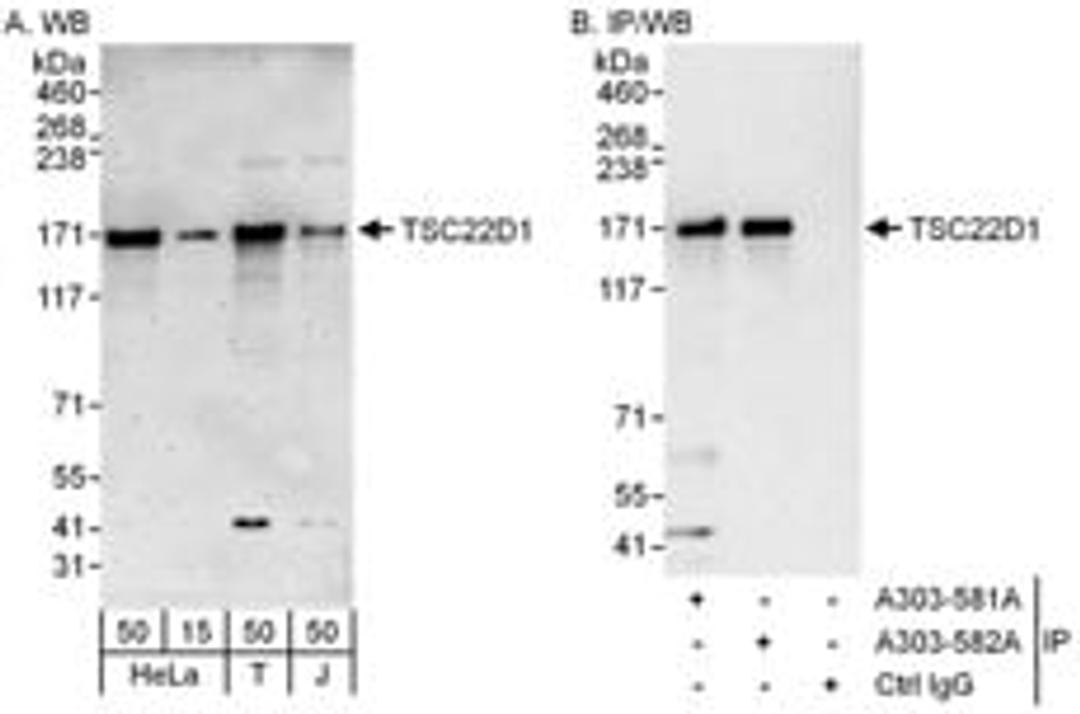 Detection of human TSC22D1 by western blot and immunoprecipitation.