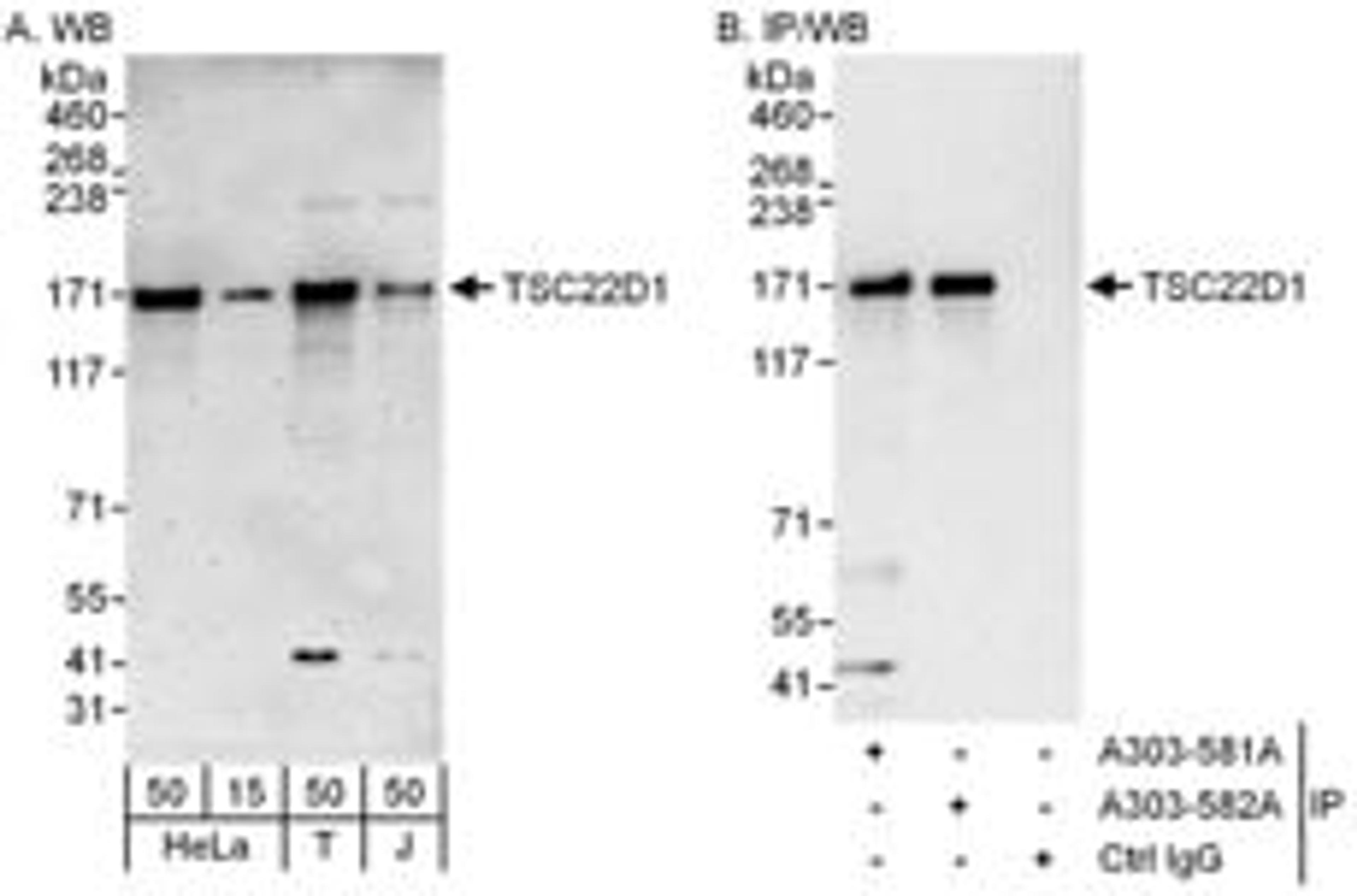 Detection of human TSC22D1 by western blot and immunoprecipitation.