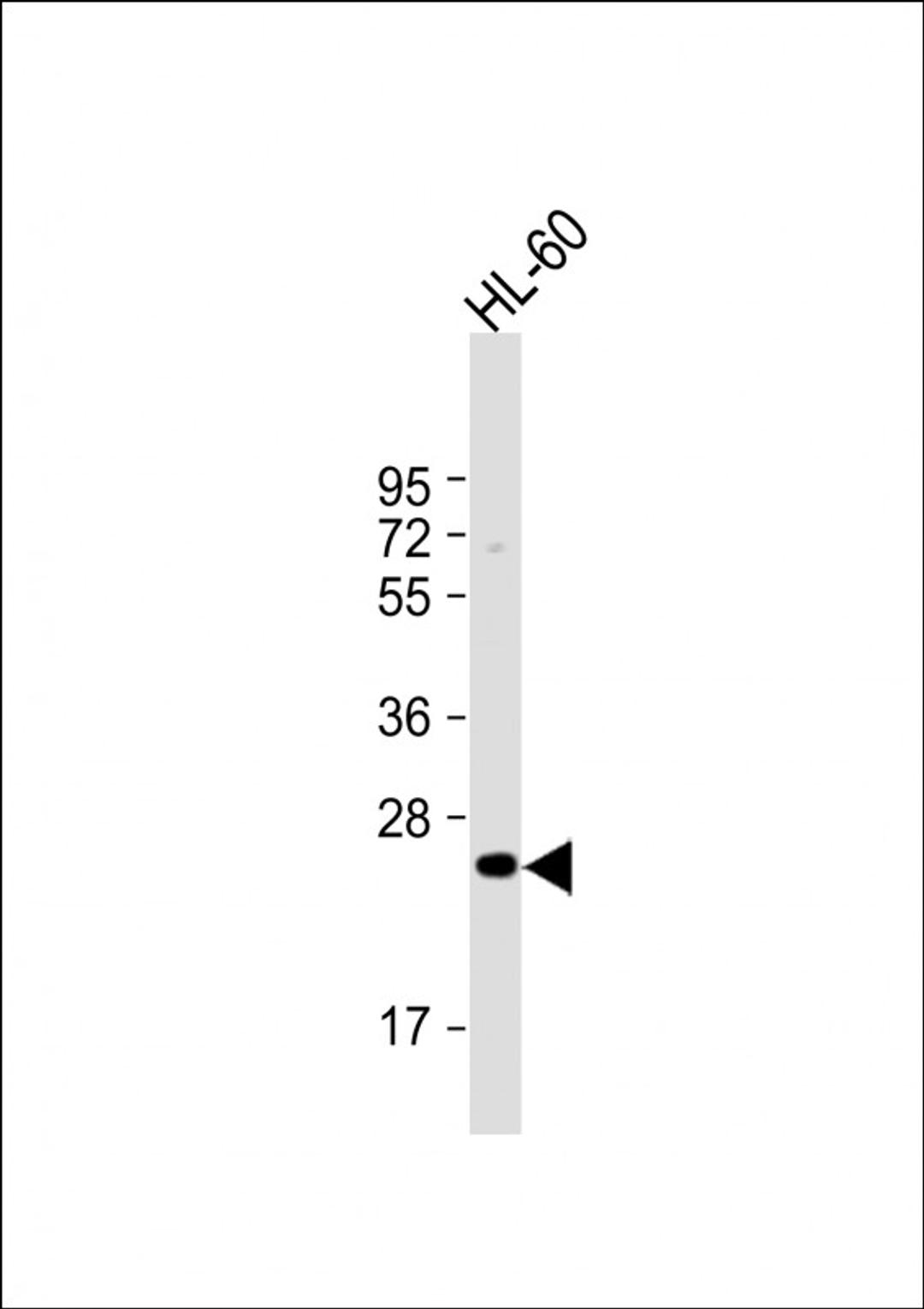 Western Blot at 1:1000 dilution + HL-60 whole cell lysate Lysates/proteins at 20 ug per lane.