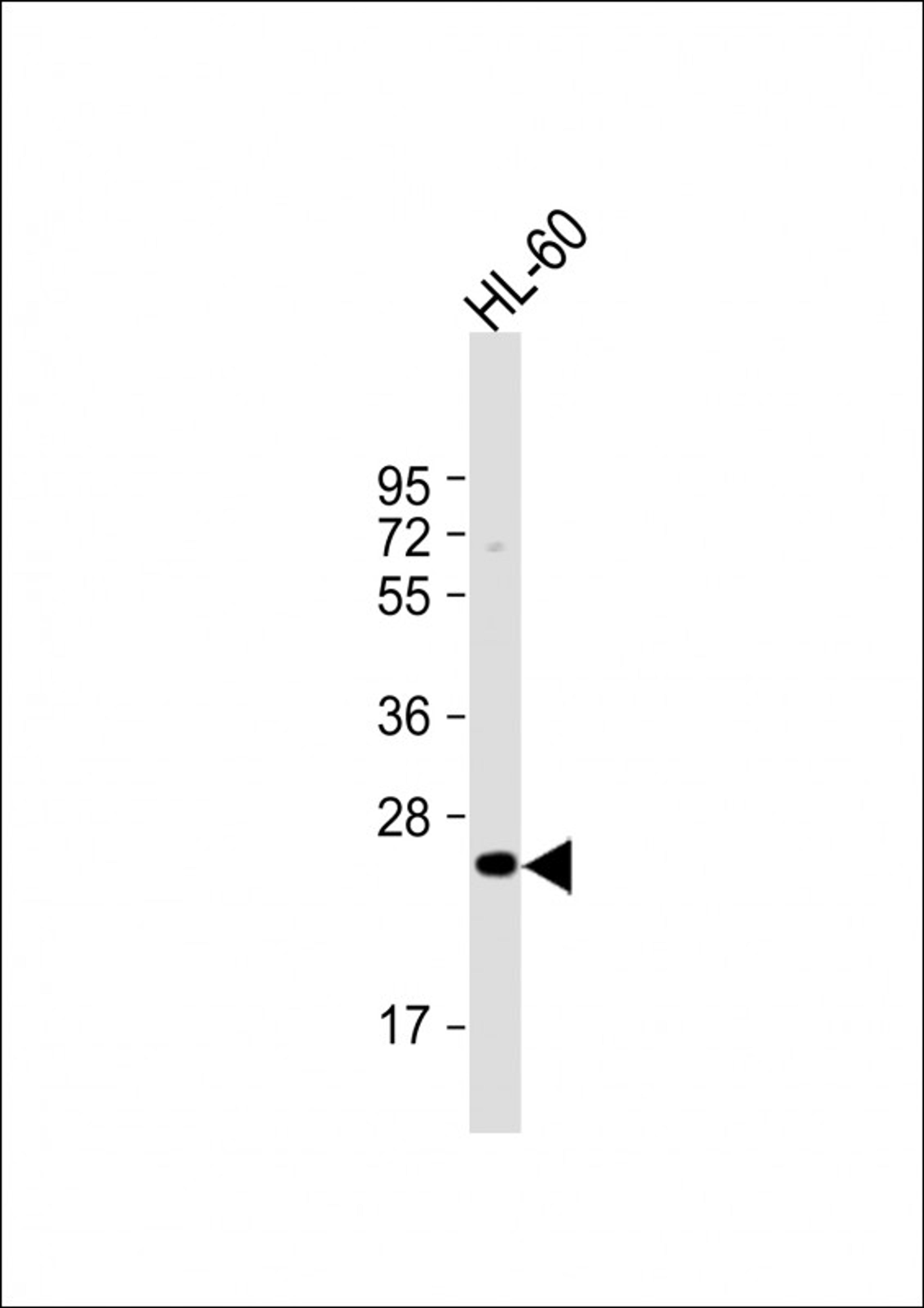 Western Blot at 1:1000 dilution + HL-60 whole cell lysate Lysates/proteins at 20 ug per lane.