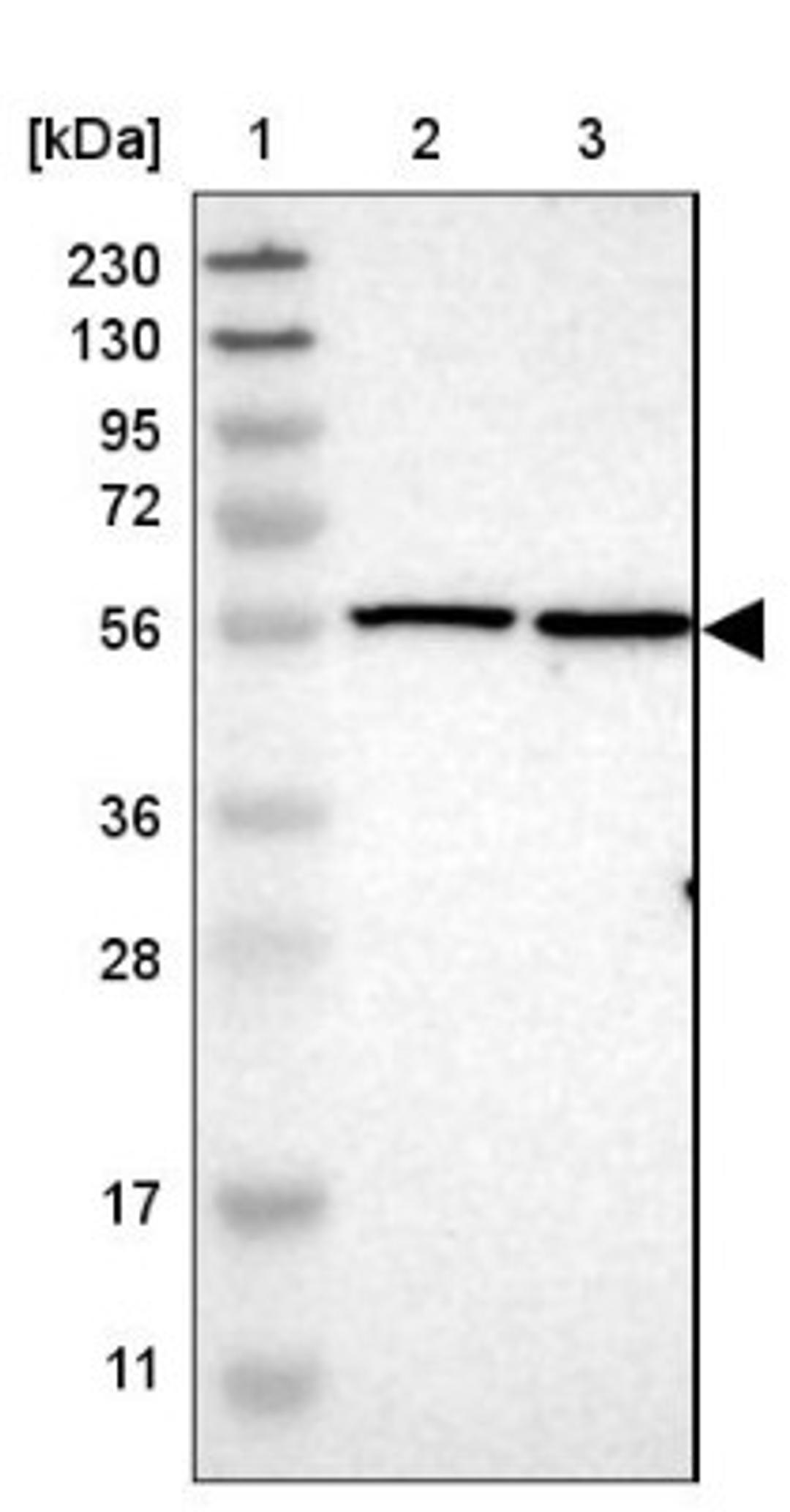 Western Blot: TMEM194A Antibody [NBP1-93649] - Lane 1: Marker [kDa] 230, 130, 95, 72, 56, 36, 28, 17, 11<br/>Lane 2: Human cell line RT-4<br/>Lane 3: Human cell line U-251MG sp