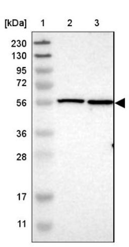 Western Blot: TMEM194A Antibody [NBP1-93649] - Lane 1: Marker [kDa] 230, 130, 95, 72, 56, 36, 28, 17, 11<br/>Lane 2: Human cell line RT-4<br/>Lane 3: Human cell line U-251MG sp