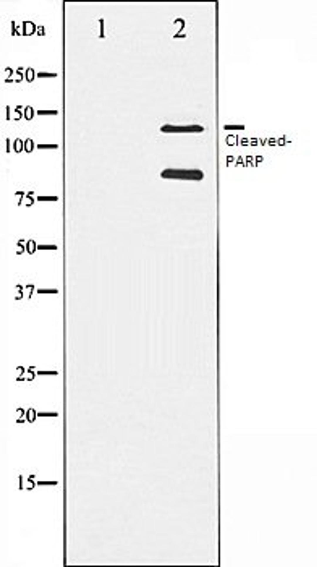 Western blot analysis of extracts from A549 cells lysates using Cleaved-PARP antibody, The lane on the left is treated with the antigen-specific peptide.