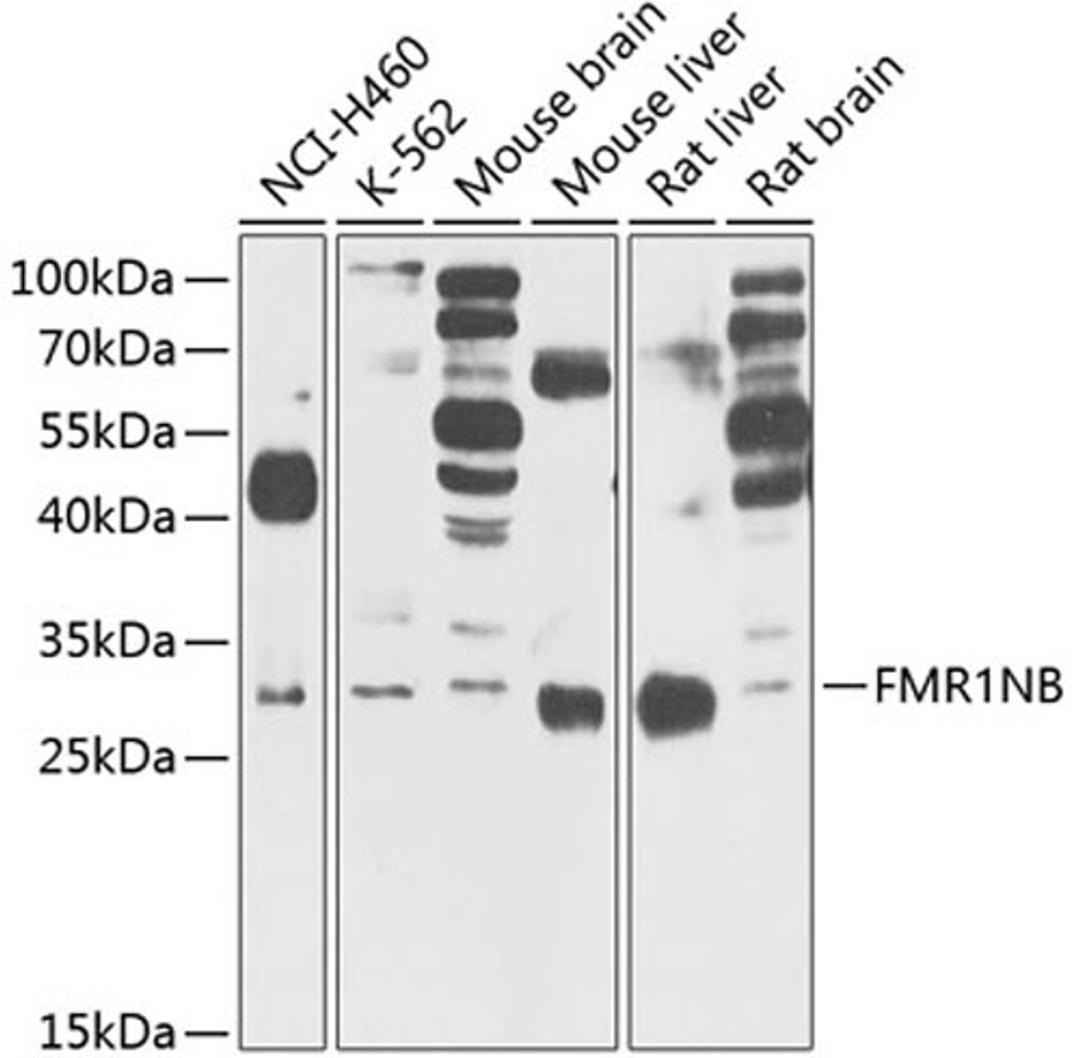 Western blot - FMR1NB Antibody (A5183)