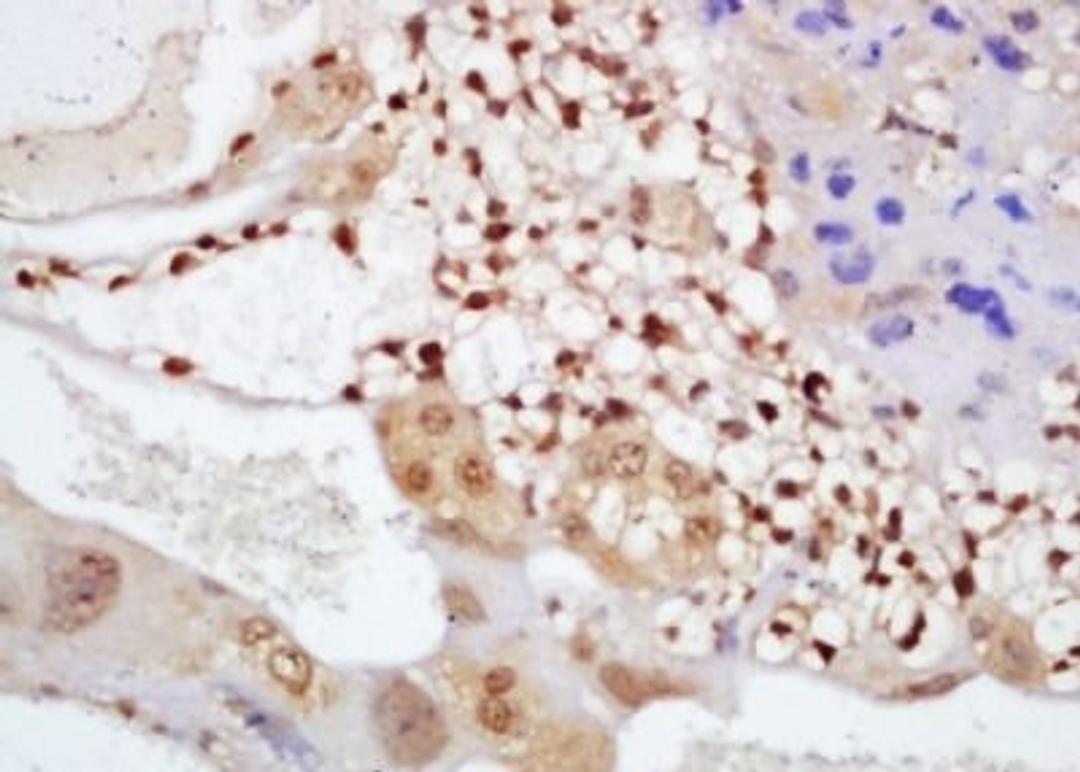 Immunohistochemical analysis of formalin-fixed paraffin embedded mouse placenta tissue using Cryptochrome 1 antibody (dilution at 1:200)