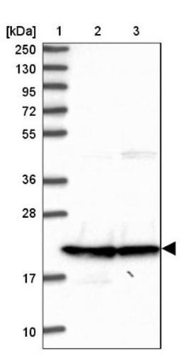 Western Blot: Calcyphosine Antibody [NBP1-91746] - Lane 1: Marker [kDa] 250, 130, 95, 72, 55, 36, 28, 17, 10<br/>Lane 2: Human cell line RT-4<br/>Lane 3: Human cell line U-251MG sp