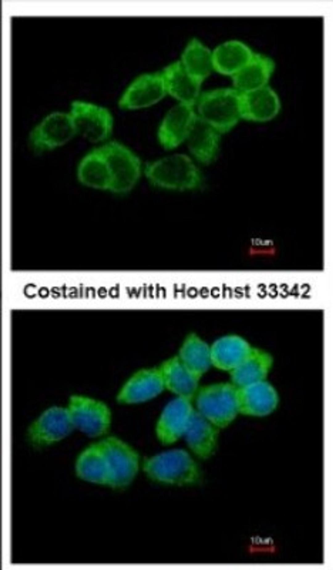 Immunocytochemistry/Immunofluorescence: TULA/STS-2 Antibody [NBP2-20763] - Immunofluorescence analysis of paraformaldehyde-fixed A431, using antibody at 1:500 dilution.