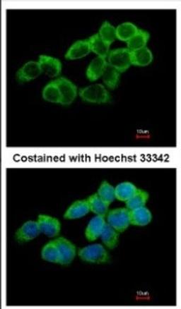 Immunocytochemistry/Immunofluorescence: TULA/STS-2 Antibody [NBP2-20763] - Immunofluorescence analysis of paraformaldehyde-fixed A431, using antibody at 1:500 dilution.