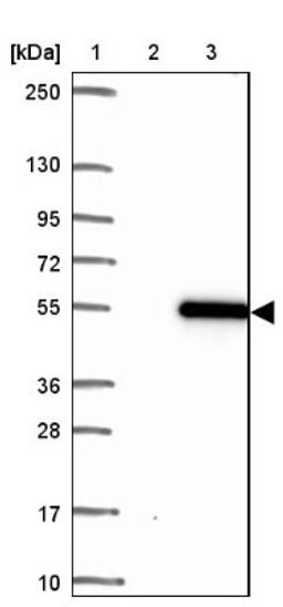 Western Blot: Thyroid receptor-interacting protein 13 Antibody [NBP2-38690] - Lane 1: Marker [kDa] 250, 130, 95, 72, 55, 36, 28, 17, 10<br/>Lane 2: Negative Control<br/>Lane 3: LY418122