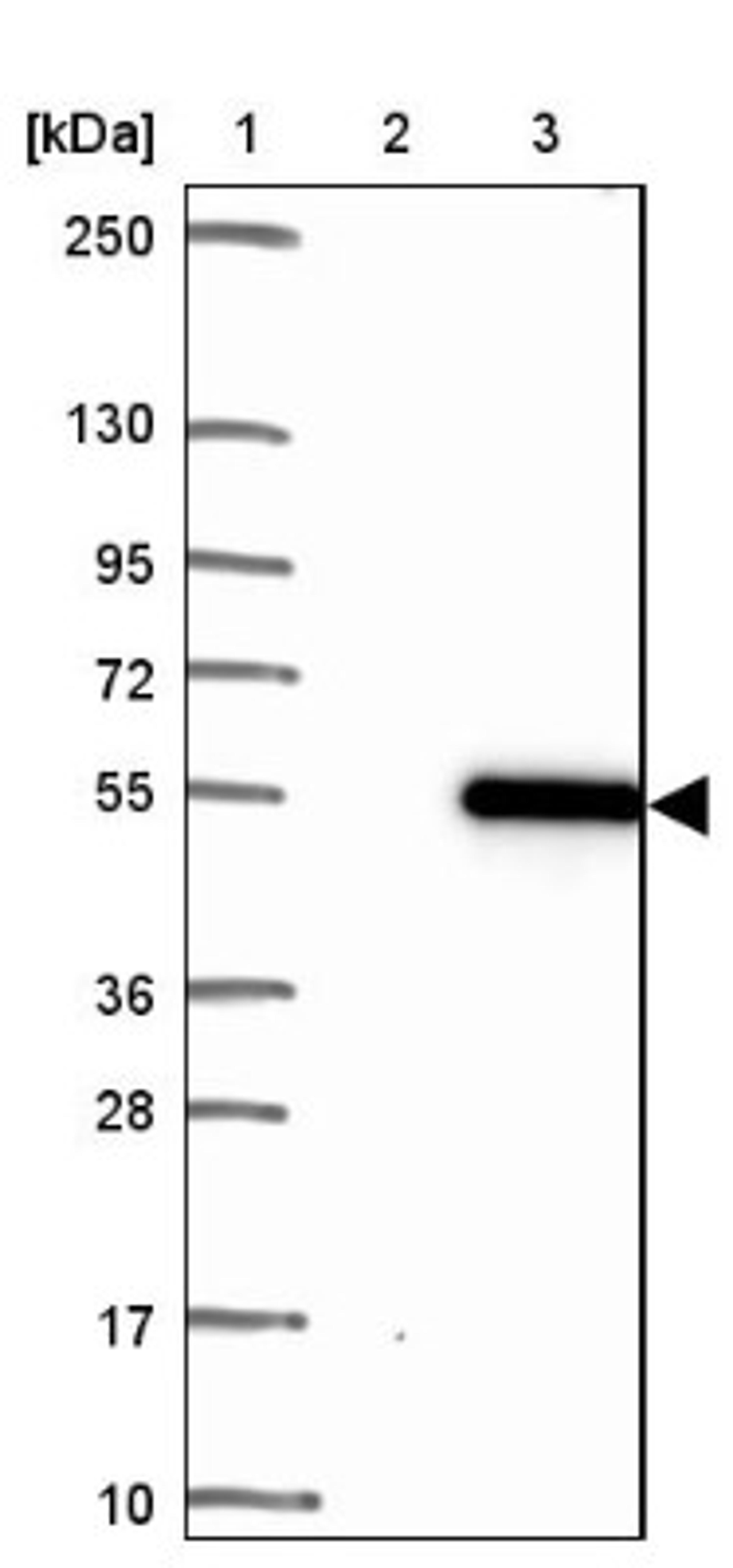 Western Blot: Thyroid receptor-interacting protein 13 Antibody [NBP2-38690] - Lane 1: Marker [kDa] 250, 130, 95, 72, 55, 36, 28, 17, 10<br/>Lane 2: Negative Control<br/>Lane 3: LY418122