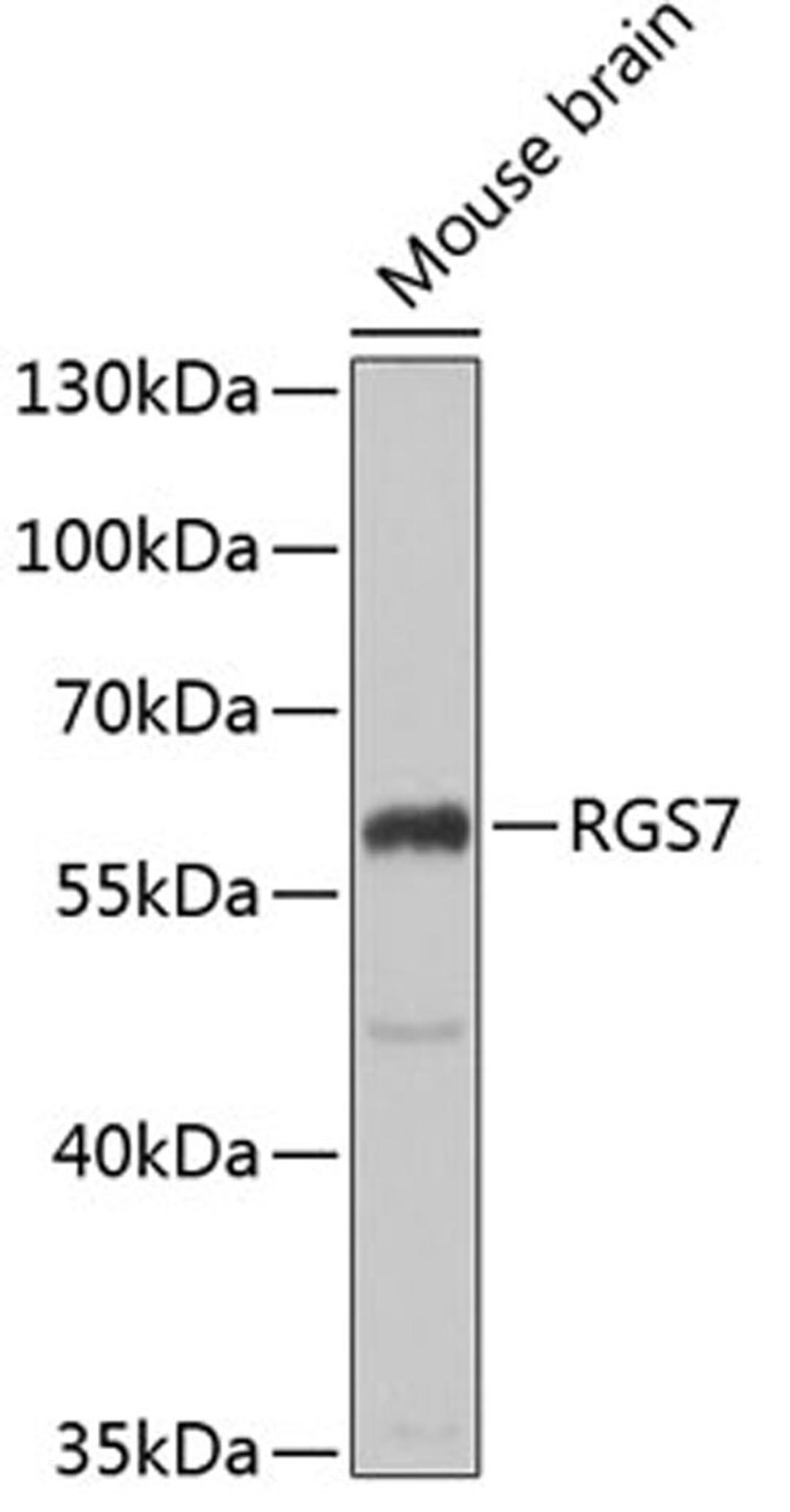 Western blot - RGS7 antibody (A6720)