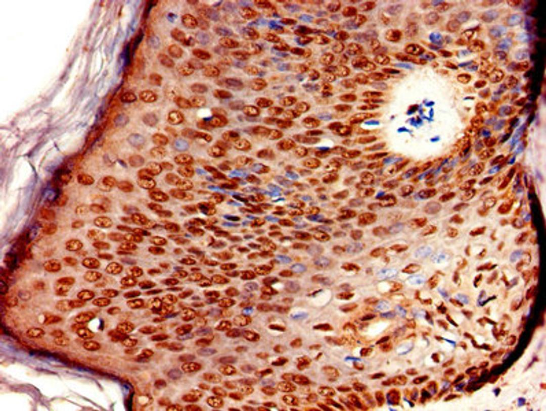 Immunohistochemistry of paraffin-embedded human skin tissue using CSB-PA724336LA01HU at dilution of 1:100